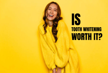 Is teeth whitening worth it?