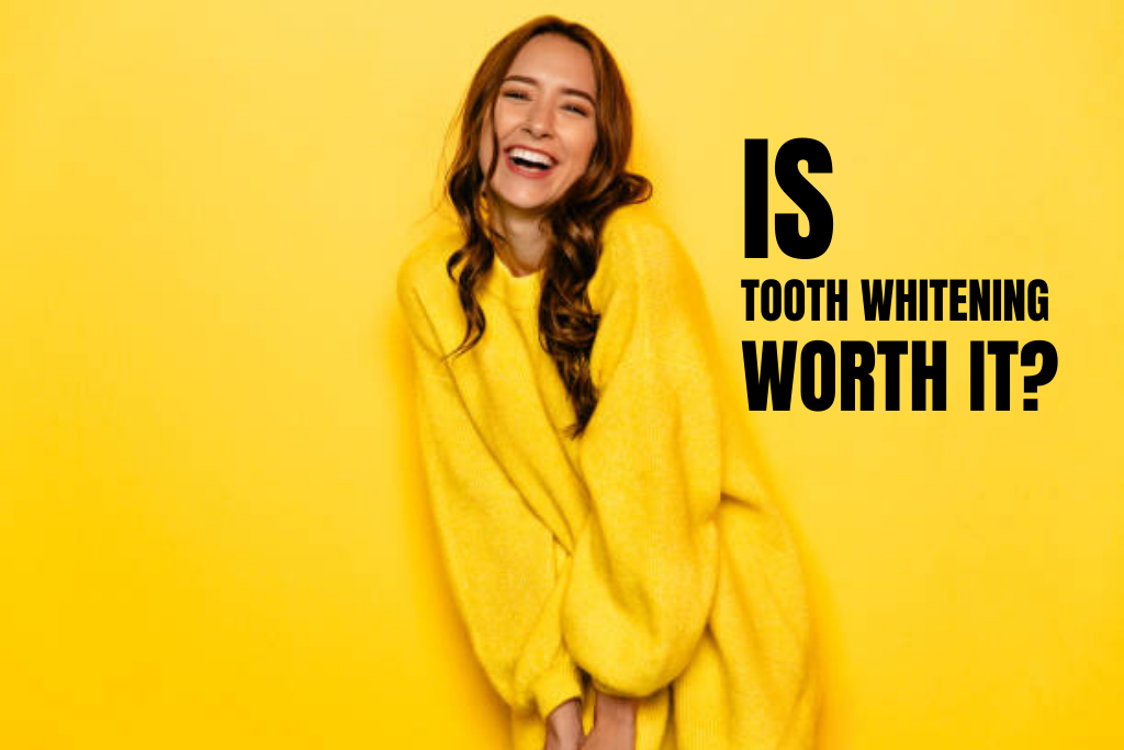 Is teeth whitening worth it?
